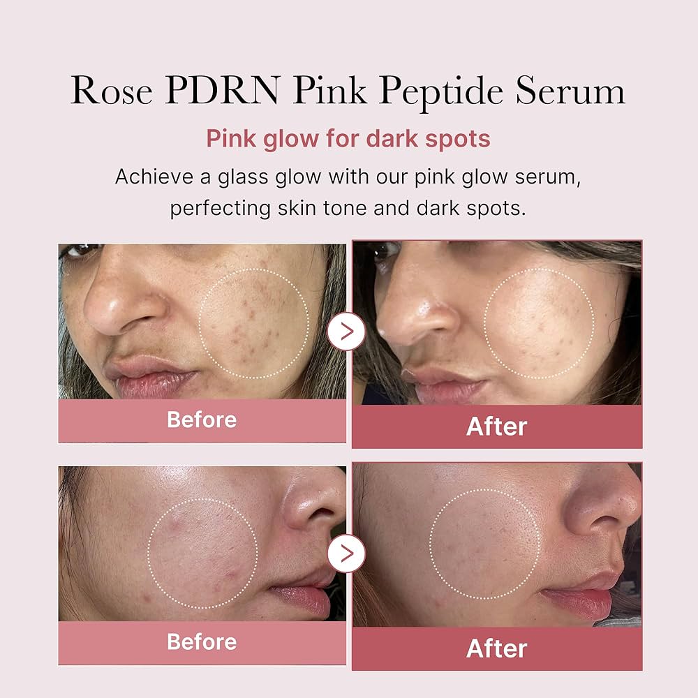 Medicube - PDRN Pink Peptide Serum [30ml]